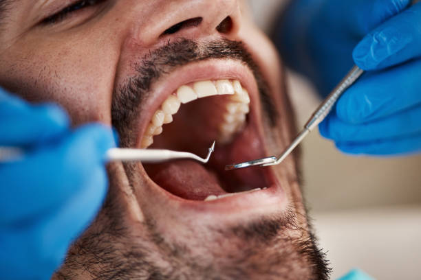 Best Mobile Emergency Dentist in Trenton, GA