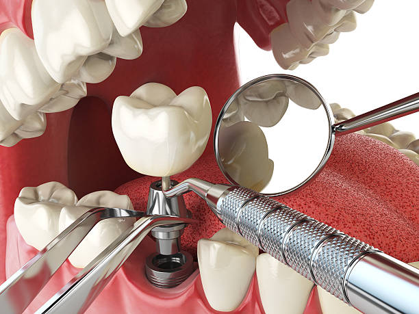 Best Emergency Dentist for Special Needs Patients in Trenton, GA