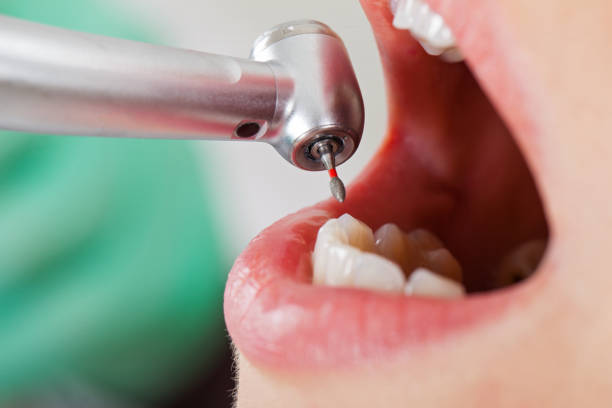 Best Emergency Dentist for Knocked-Out Tooth in Trenton, GA